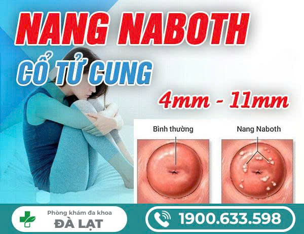 Hình ảnh minh họa